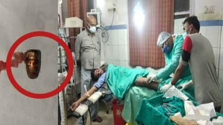 Dr. Mahavir Prasad Gupta fired a bullet from the young man's leg