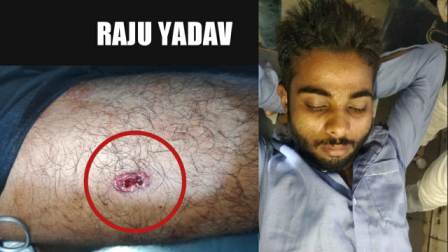 Dulour Jagdishpur - Raju Yadav of Dev Tola shot dead